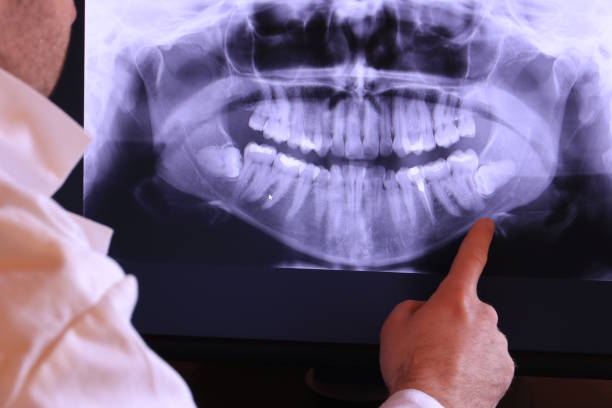 Best Emergency Dental Care for Broken or Chipped Teeth in Galax, VA