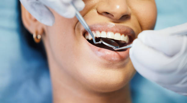 Best Emergency Tooth Extraction in Galax, VA